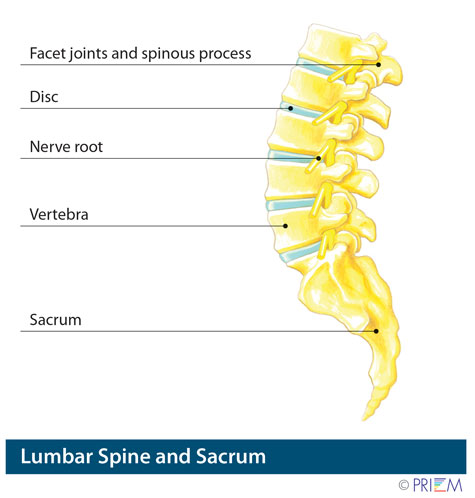 nonsurgical treatment for back pain San Jose