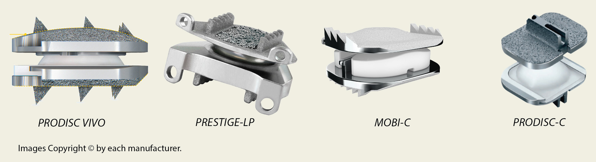 4 different artificial discs, including the prodisc vivo, prestige-lp, mobi-c, and prodisc-c