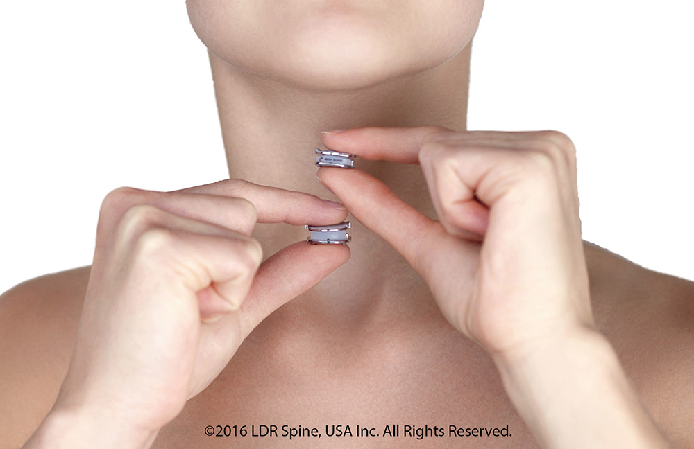 Mobi C artificial disc held up in front of a persons neck to show sizes